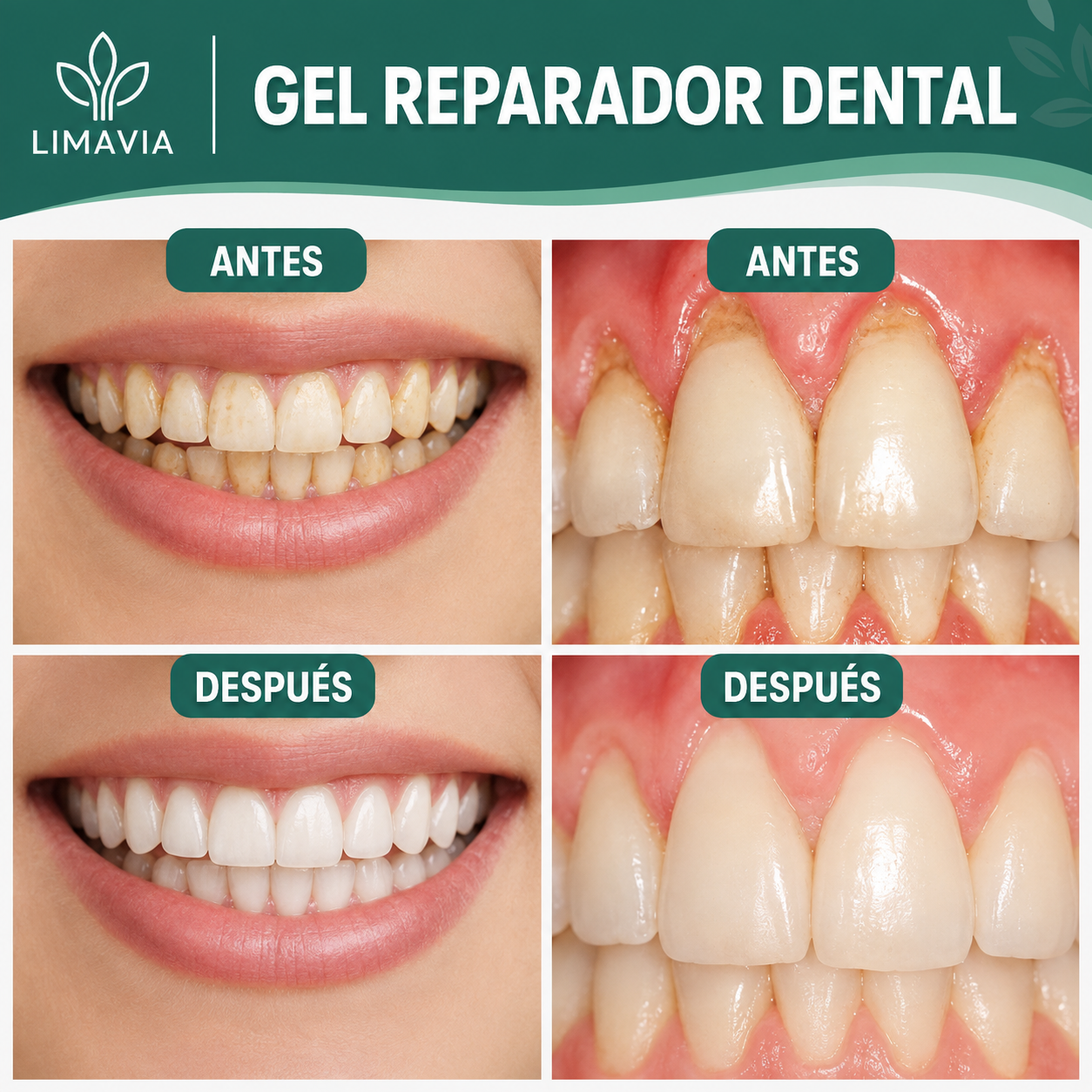 Gel reparador dental